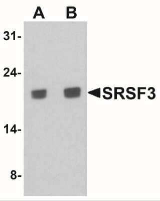 Western Blot: SFRS3 Antibody [NBP2-41316] - Western blot analysis of SRSF3 in K562 cell lysate with SRSF3 antibody at (A) 1 and (B) 2 ug/ml.