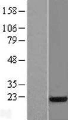 Western Blot: SFRS3 Overexpression Lysate (Adult Normal) [NBL1-15889] Left-Empty vector transfected control cell lysate (HEK293 cell lysate); Right -Over-expression Lysate for SFRS3.