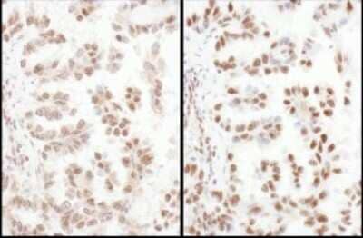 Immunohistochemistry SFRS4 Antibody