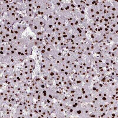 Immunohistochemistry-Paraffin: SFRS4 Antibody [NBP2-13384] - Staining of human liver shows strong nuclear positivity in hepatocytes.