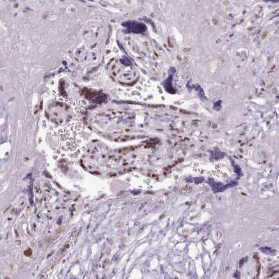 Immunohistochemistry-Paraffin: SFRS4 Antibody [NBP2-13384] - Staining of human placenta shows moderate to strong nuclear positivity in trophoblastic cells.