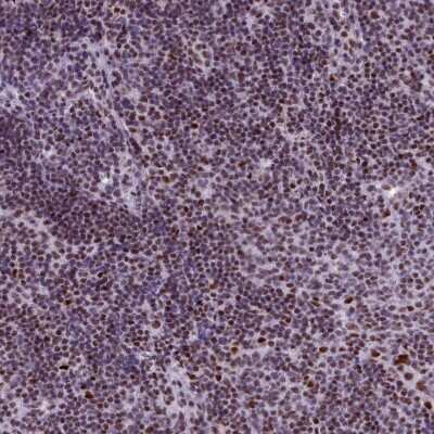 Immunohistochemistry-Paraffin: SFRS4 Antibody [NBP2-13384] - Staining of human lymph node shows moderate to strong nuclear positivity in non - germinal center cells.