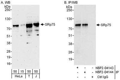 Immunoprecipitation: SFRS4 Antibody [NBP2-04143] - Samples: Whole cell lysate from HeLa (15 and 50 ug for WB; 1 mg for IP, 20% of IP loaded), 293T (T; 50 ug) and Jurkat (J; 50 ug) cells. Antibodies: Affinity purified rabbit anti-SRp75 antibody NBP2-04143 used for WB at 0.1 ug/ml (A) and 1 ug/ml (B) and used for IP at 6 ug/mg lysate. SRp75 was also immunoprecipitated by rabbit anti-SRp75 antibody NBP2-04144, which recognizes a downstream epitope. Detection: Chemiluminescence with exposure times of 3 minutes (A) and 3 seconds (B).