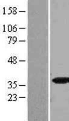 Western Blot SFRS5 Overexpression Lysate