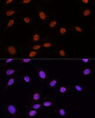 Immunocytochemistry/Immunofluorescence: SFRS7 Antibody [NBP2-94049] - Analysis of U-2 OS cells using SFRS7 at dilution of 1:100. Blue: DAPI for nuclear staining.