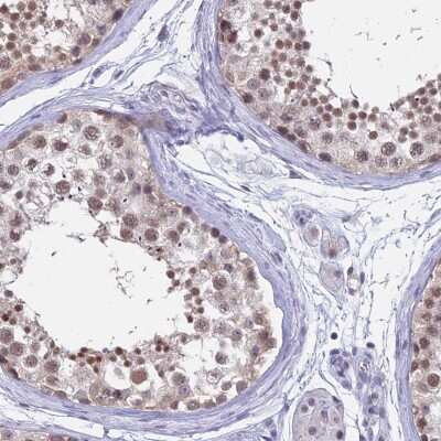 Immunohistochemistry-Paraffin SFRS7 Antibody