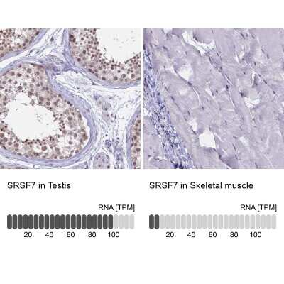 Immunohistochemistry-Paraffin: SFRS7 Antibody [NBP1-92382] - Staining in human testis and skeletal muscle tissues using anti-SRSF7 antibody. Corresponding SRSF7 RNA-seq data are presented for the same tissues.