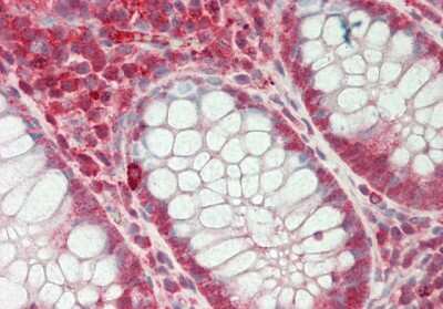 Immunohistochemistry-Paraffin: SFRS7 Antibody [NBP2-88251] - Rabbit Anti-SFRS7 antibody. Formalin Fixed Paraffin Embedded Tissue: Human Colon. Primary antibody Concentration: 1:200. Secondary Antibody: Donkey anti-Rabbit-Cy3. Secondary Antibody Concentration: 1:200. Magnification: 20x.