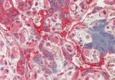 Immunohistochemistry-Paraffin: SFRS7 Antibody [NBP2-88251] - Rabbit Anti-SFRS7 antibody. Formalin Fixed Paraffin Embedded Tissue: Human Placenta. Primary antibody Concentration: 1:200. Secondary Antibody: Donkey anti-Rabbit-Cy3. Secondary Antibody Concentration: 1:200. Magnification: 20x.