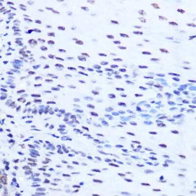 Immunohistochemistry-Paraffin: SFRS7 Antibody [NBP2-94049] - Immunohistochemistry of paraffin-embedded human esophageal using SFRS7 Rabbit pAb (NBP2-94049) at dilution of 1:100 (40x lens). Perform microwave antigen retrieval with 10 mM Tris/EDTA buffer pH 9.0 before commencing with IHC staining protocol.