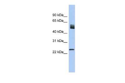 Western Blot: SFRS7 Antibody [NBP2-88251] - WB Suggested Anti-SFRS7 Antibody Titration: 0.2-1 ug/ml. ELISA Titer: 1:62500. Positive Control: Human Lung