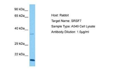 Western Blot: SFRS7 Antibody [NBP2-88251] - Host: Rabbit. Target Name: SRSF7. Sample Tissue: Human A549 Whole Cell. Antibody Dilution: 3ug/ml