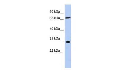 Western Blot: SFRS7 Antibody [NBP2-88252] - WB Suggested Anti-SFRS7 Antibody Titration: 0.2-1 ug/ml. ELISA Titer: 1:1562500. Positive Control: Human Muscle