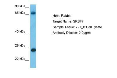 Western Blot: SFRS7 Antibody [NBP2-88254] - Host: Rabbit. Target Name: SRSF7. Sample Type: 721_B Whole Cell. Antibody Dilution: 1.0ug/ml