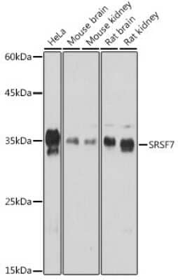 Western Blot: SFRS7 Antibody [NBP2-94049] - Western blot analysis of extracts of various cell lines, using SFRS7 Rabbit pAb (NBP2-94049) at 1:1000 dilution. Secondary antibody: HRP Goat Anti-Rabbit IgG (H+L) at 1:10000 dilution. Lysates/proteins: 25ug per lane. Blocking buffer: 3% nonfat dry milk in TBST. Detection: ECL Basic Kit. Exposure time: 60s.