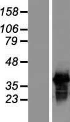 Western Blot: SFRS7 Overexpression Lysate (Adult Normal) [NBL1-15892] Left-Empty vector transfected control cell lysate (HEK293 cell lysate); Right -Over-expression Lysate for SFRS7.