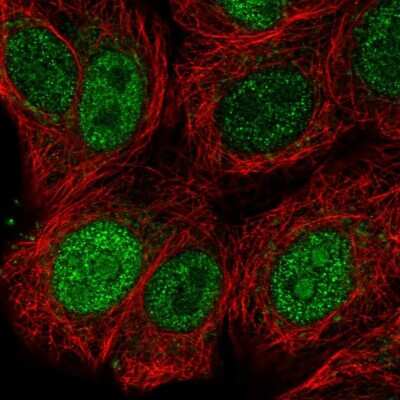 Immunocytochemistry/Immunofluorescence: SFRS9 Antibody [NBP2-13385] - Immunofluorescent staining of human cell line MCF7 shows localization to nucleoplasm & nucleoli. Antibody staining is shown in green.