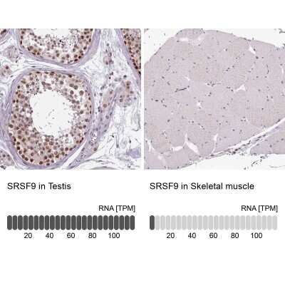 Immunohistochemistry-Paraffin: SFRS9 Antibody [NBP2-13385] - Analysis in human testis and skeletal muscle tissues using NBP2-13385 antibody. Corresponding SRSF9 RNA-seq data are presented for the same tissues.
