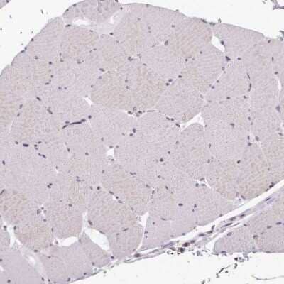 Immunohistochemistry-Paraffin: SFRS9 Antibody [NBP2-13385] - Staining of human skeletal muscle shows no positivity in myocytes as expected.