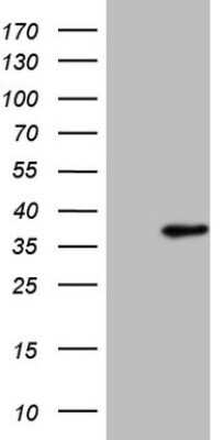 Western Blot: SFRS9 Antibody (OTI5G7) - Azide and BSA Free [NBP2-74152] - Analysis of HEK293T cells were transfected with the pCMV6-ENTRY control (Left lane) or pCMV6-ENTRY SRSF9.