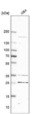 Western Blot: SFRS9 Antibody [NBP2-13385] - Analysis in human cell line NB4.