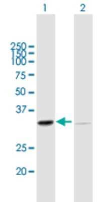 Western Blot: SFXN1 Antibody [H00094081-B01P] - Analysis of SFXN1 expression in transfected 293T cell line by SFXN1 polyclonal antibody.  Lane 1: SFXN1 transfected lysate(35.42 KDa). Lane 2: Non-transfected lysate.