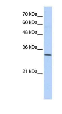 Western Blot: SFXN1 Antibody [NBP1-59615] - Transfected 293T cell lysate, concentration 0.2-1 ug/ml.