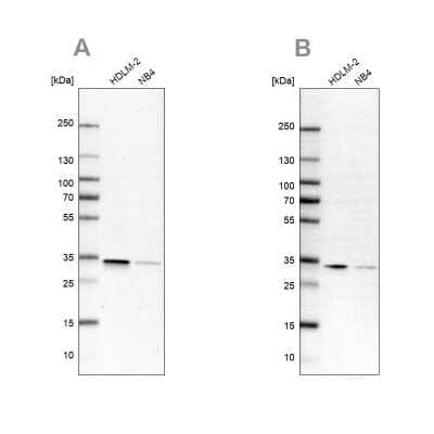Western Blot: SFXN1 Antibody [NBP2-57172] - Analysis using Anti-SFXN1 antibody NBP2-57172 (A) shows similar pattern to independent antibody NBP1-83708 (B).