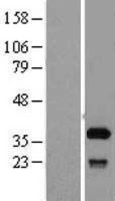 Western Blot: SFXN1 Overexpression Lysate (Adult Normal) [NBL1-15898] Left-Empty vector transfected control cell lysate (HEK293 cell lysate); Right -Over-expression Lysate for SFXN1.