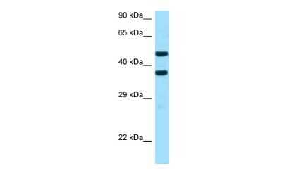 Western Blot: SFXN2 Antibody [NBP2-88255] - WB Suggested Anti-SFXN2 Antibody. Titration: 1.0 ug/ml. Positive Control: NCI-H226 Whole Cell