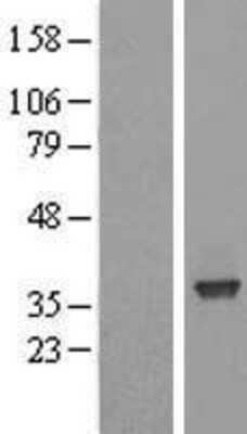 Western Blot: SFXN3 Overexpression Lysate (Adult Normal) [NBL1-15900] Left-Empty vector transfected control cell lysate (HEK293 cell lysate); Right -Over-expression Lysate for SFXN3.
