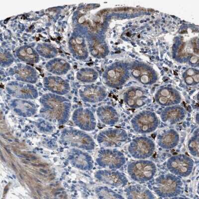 Immunohistochemistry-Paraffin SGCZ Antibody