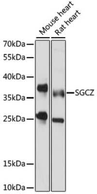 Western Blot: SGCZ Antibody [NBP2-94447] - Analysis of extracts of various cell lines, using SGCZ at 1000 dilution. Secondary antibody: HRP Goat Anti-Rabbit IgG (H+L) at 1:10000 dilution. Lysates/proteins: 25ug per lane. Blocking buffer: 3% nonfat dry milk in TBST. Detection: ECL Basic Kit . Exposure time: 15s.