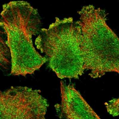 Immunocytochemistry/Immunofluorescence: SGEF Antibody [NBP2-55416] - Staining of human cell line U-251 MG shows localization to nucleoplasm, plasma membrane & cytosol.