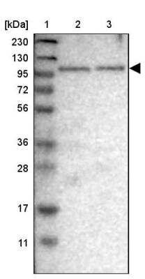 Western Blot: SGEF Antibody [NBP1-88006] - Lane 1: Marker  [kDa] 230, 130, 95, 72, 56, 36, 28, 17, 11.  Lane 2: Human cell line RT-4.  Lane 3: Human cell line U-251MG sp
