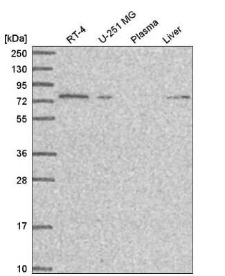 Western Blot: SGEF Antibody [NBP2-55416] - Analysis in human cell line RT-4, human cell line U-251 MG, human plasma and human liver tissue.