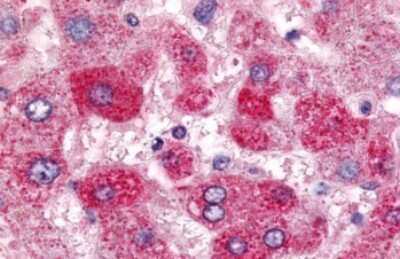 Immunohistochemistry-Paraffin: SGK2 Antibody [NLS7221] - Anti-SGK2 antibody IHC of human liver. Immunohistochemistry of formalin-fixed, paraffin-embedded tissue after heat-induced antigen retrieval. Antibody dilution 7 ug/ml.
