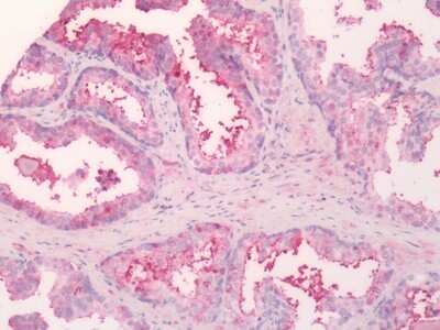 Immunohistochemistry-Paraffin: SGLT1/SLC5A1 Antibody [NB110-40432] - Analysis of anti-SGLT1 antibody with human prostate.