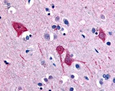 Immunohistochemistry-Paraffin: SGLT1/SLC5A1 Antibody [NB110-40436] - Analysis of anti-SLC5A11 antibody with human brain, cortex at concentration 10 ug/ml.