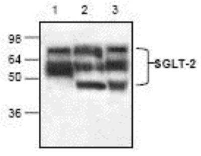 Western Blot: SGLT2/SLC5A2 Antibody [NBP1-45853] - Analysis of SGLT-2 in lysate from Jurkat cells (Lane 1), mouse small intestine (Lane 2) and rat kidney (Lane 3).