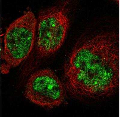 <b>Orthogonal Strategies Validation. </b>Immunocytochemistry/Immunofluorescence: SGOL2 Antibody [NBP1-83567] - Staining of human cell line A-431 shows localization to nucleoplasm & nuclear bodies. Antibody staining is shown in green.