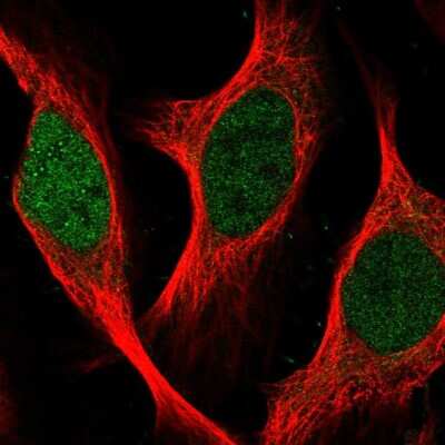 Immunocytochemistry/Immunofluorescence: SGOL2 Antibody [NBP2-58930] - Staining of human cell line U-2 OS shows localization to nucleoplasm.