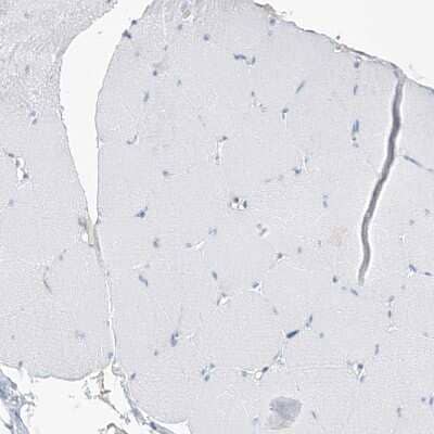 Immunohistochemistry-Paraffin: SGOL2 Antibody [NBP1-83567] - Staining of human skeletal muscle shows no positivity in myocytes as expected.