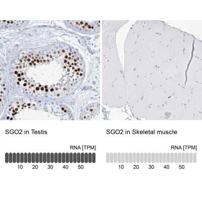 Immunohistochemistry-Paraffin: SGOL2 Antibody [NBP1-83567] - Staining in human testis and skeletal muscle tissues.. Corresponding SGO2 RNA-seq data are presented for the same tissues.