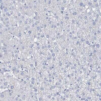 Immunohistochemistry-Paraffin: SGOL2 Antibody [NBP1-83567] - Staining of human liver shows no positivity in hepatocytes as expected.