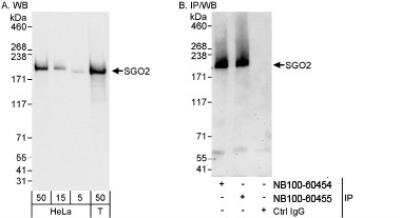 Western Blot: SGOL2 Antibody [NB100-60455] - Detection of Human SGO2 on HeLa whole cell lysate using NB100-60455. SGO2 was also immunoprecipitated by rabbit anti-SGO2 antibody NB100-60454.