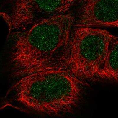 Immunocytochemistry/Immunofluorescence: SGPP1 Antibody [NBP2-76561] - Staining of human cell line A-431 shows localization to nucleus. Antibody staining is shown in green.