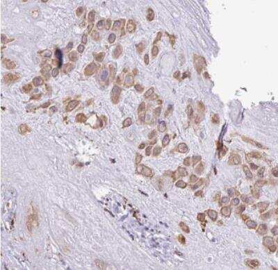 Immunohistochemistry-Paraffin: SGPP1 Antibody [NBP2-13303] - Staining of human placenta shows moderate membranous positivity in decidula cells.