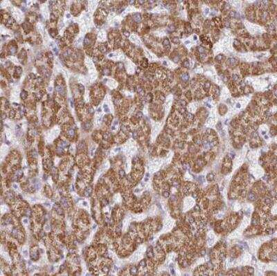 Immunohistochemistry-Paraffin: SGPP1 Antibody [NBP2-13303] - Staining of human liver shows strong granular cytoplasmic positivity in hepatocytes.