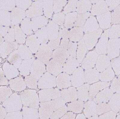 Immunohistochemistry-Paraffin: SGPP1 Antibody [NBP2-13303] - Staining of human skeletal muscle shows very weak cytoplasmic positivity in myocytes.
